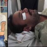 सतना में रोड टेंडर पर बवाल: हवाई फायरिंग के बाद पिस्टल की बट से हमला, CCTV खंगाल रही पुलिस