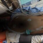 भिवाड़ी में पुलिस कस्टडी में नाबालिग से बर्बरता, हालत गंभीर, 4 पुलिसकर्मियों पर केस