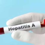 यूपी में हेपेटाइटिस ए का बड़ा खतरा, 97% सैंपल पॉजिटिव मिले